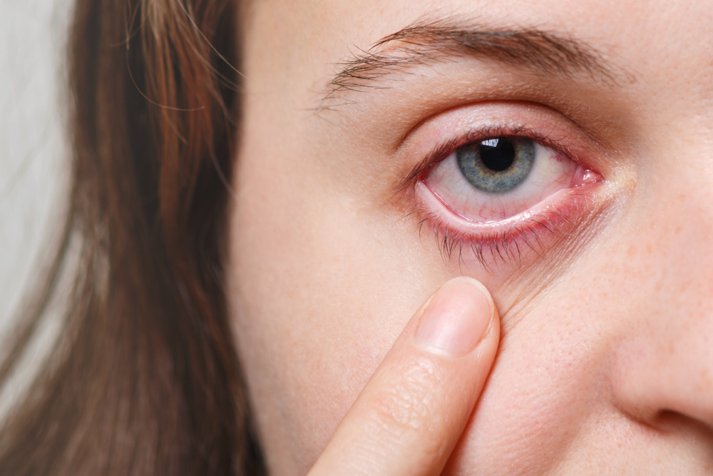 Ojos secos