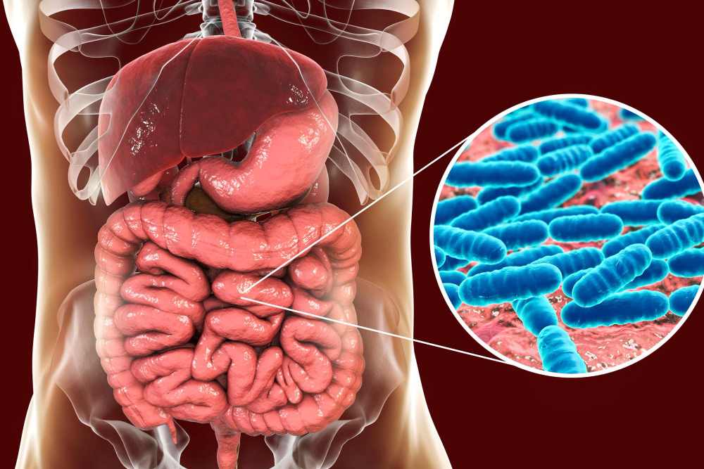 SIBo sobrecrecimiento bacteriano